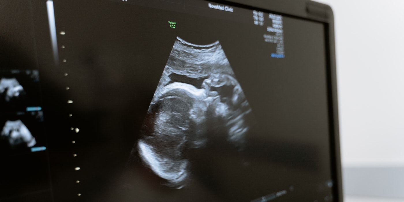 Ultrasonography